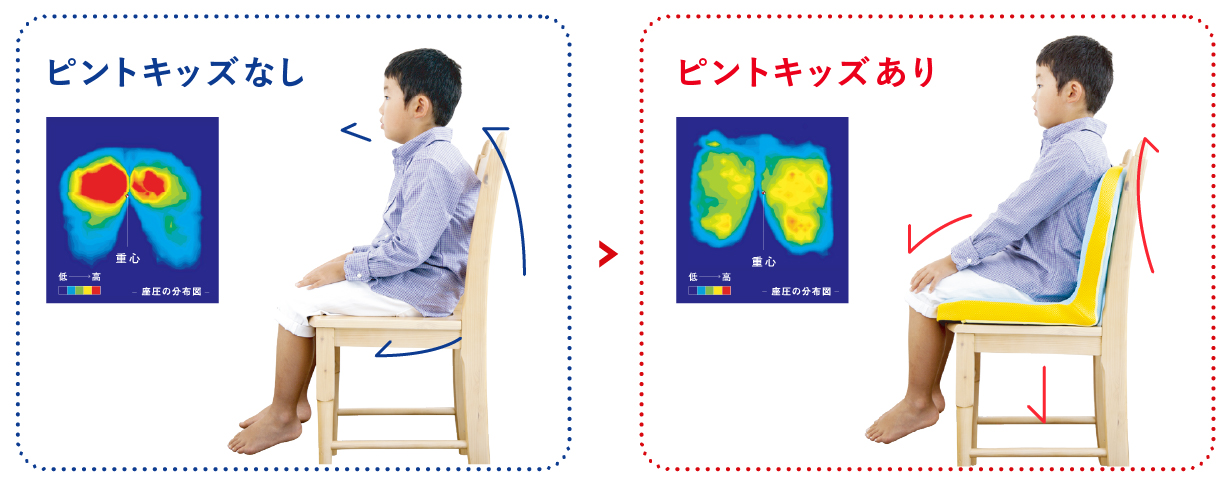 �ԥ�ȥ��å���̵ͭ�ˤ����������